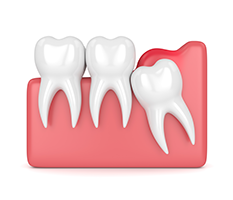 Addison Dental Studio | Dental Cleanings, Implant Restorations and Laser Dentistry