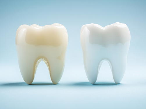 Addison Dental Studio | All-on-4 reg , Emergency Treatment and Full Mouth Reconstruction