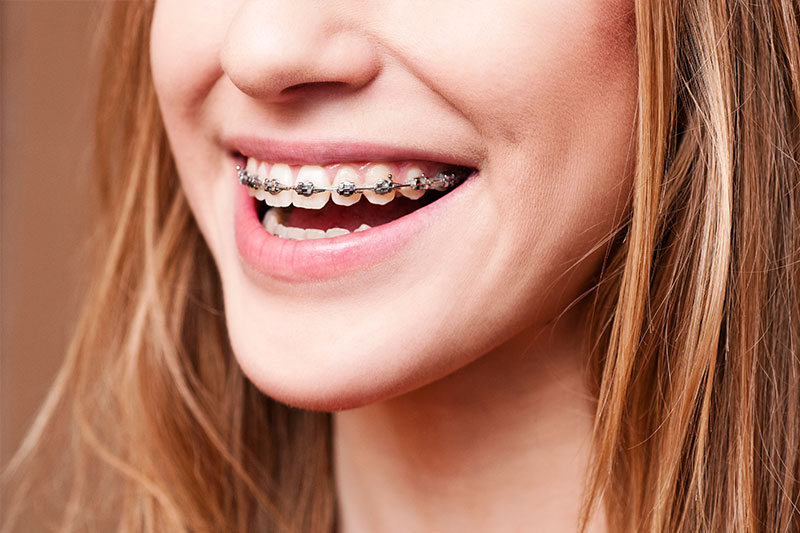 Orthodontics in Addison