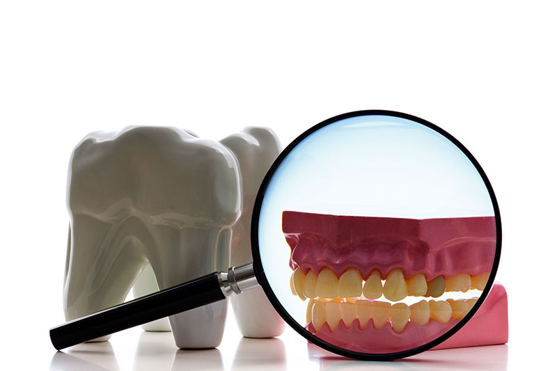 Root Canal in Addison