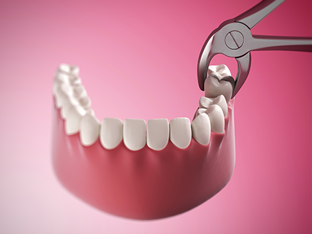 Addison Dental Studio | Fluoride Treatment, Emergency Treatment and Dental Cleanings